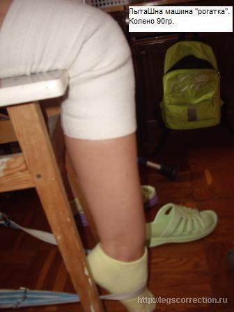 Контрактура коленного сустава лечение народными средствами отзывы