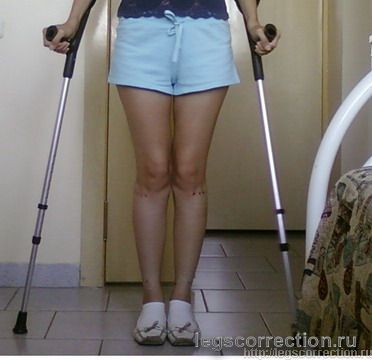 сразу после снятия