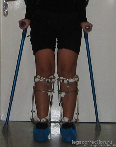 Img 1