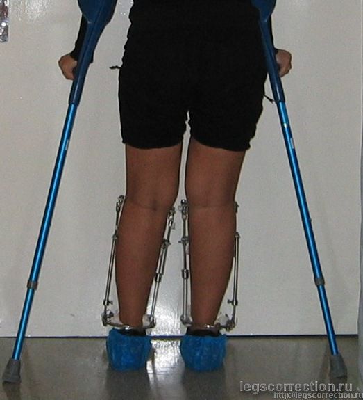 Img 4