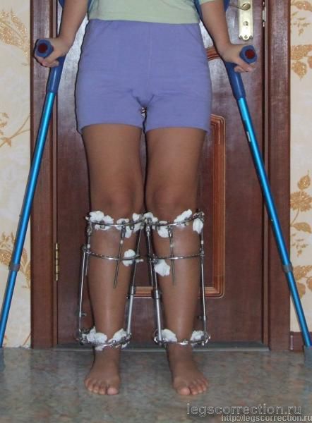 Legs 039