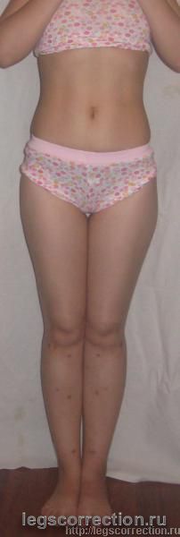 Img 0140