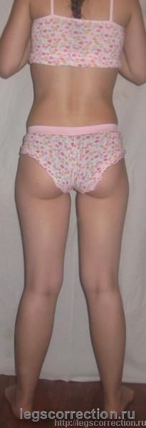 Img 0142