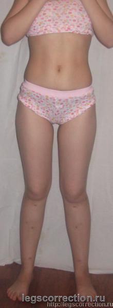 Img 0143