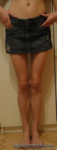 Dsc00915