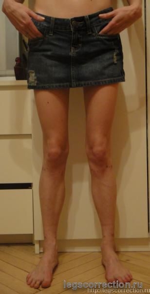 Dsc00917