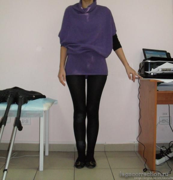 1 день после снятия АП