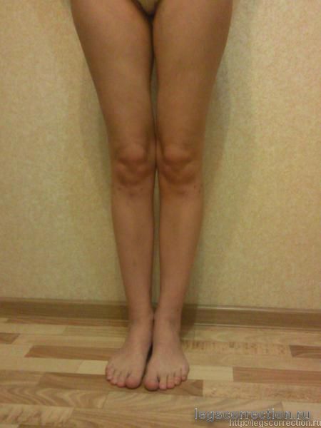 новые ножки