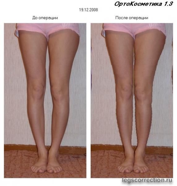 моделирование Тетерина