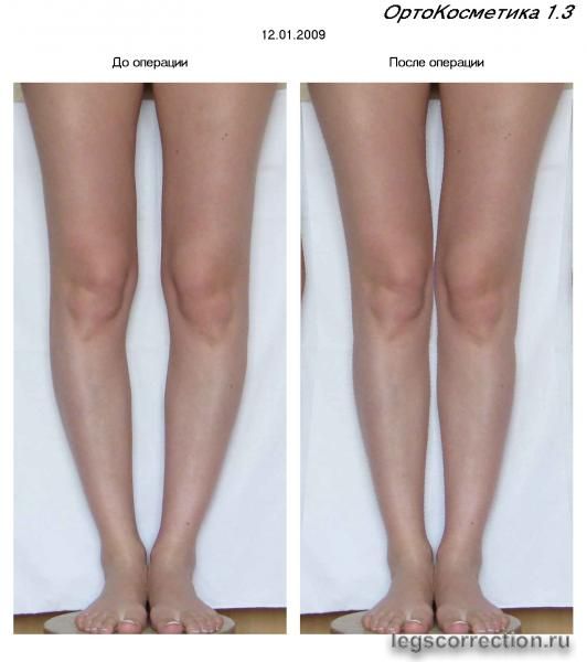 моделирование