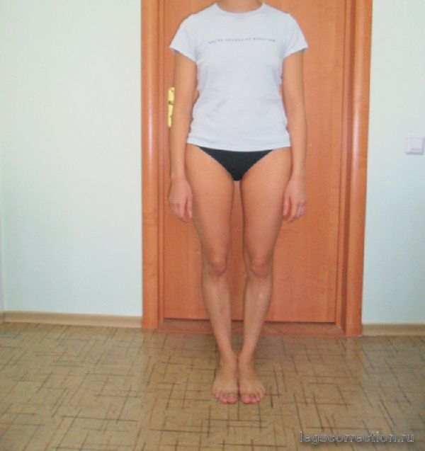 Ножки ДО
