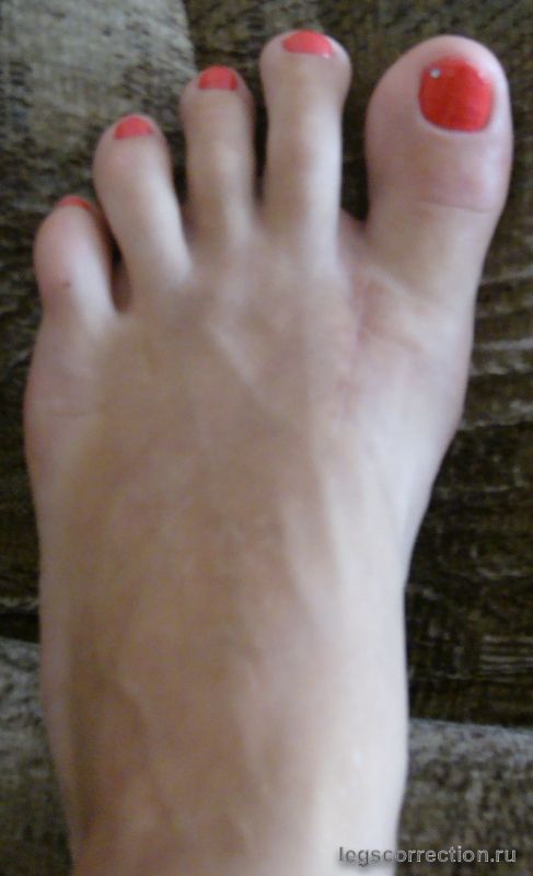 Dsc03963