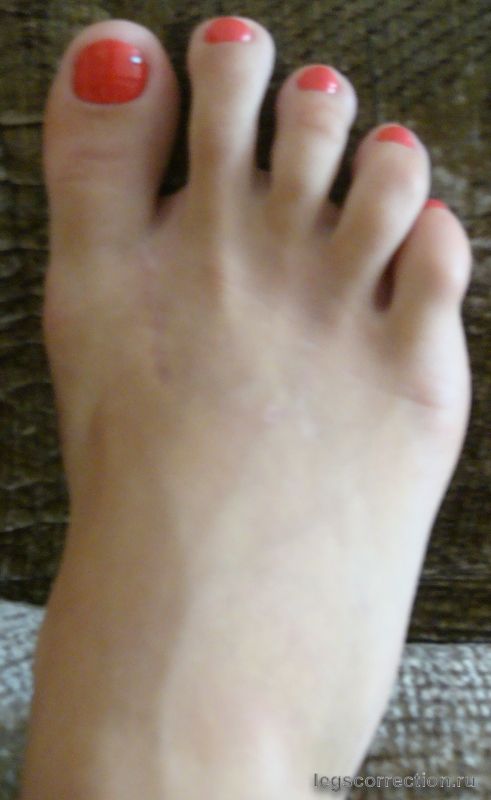 Dsc03962