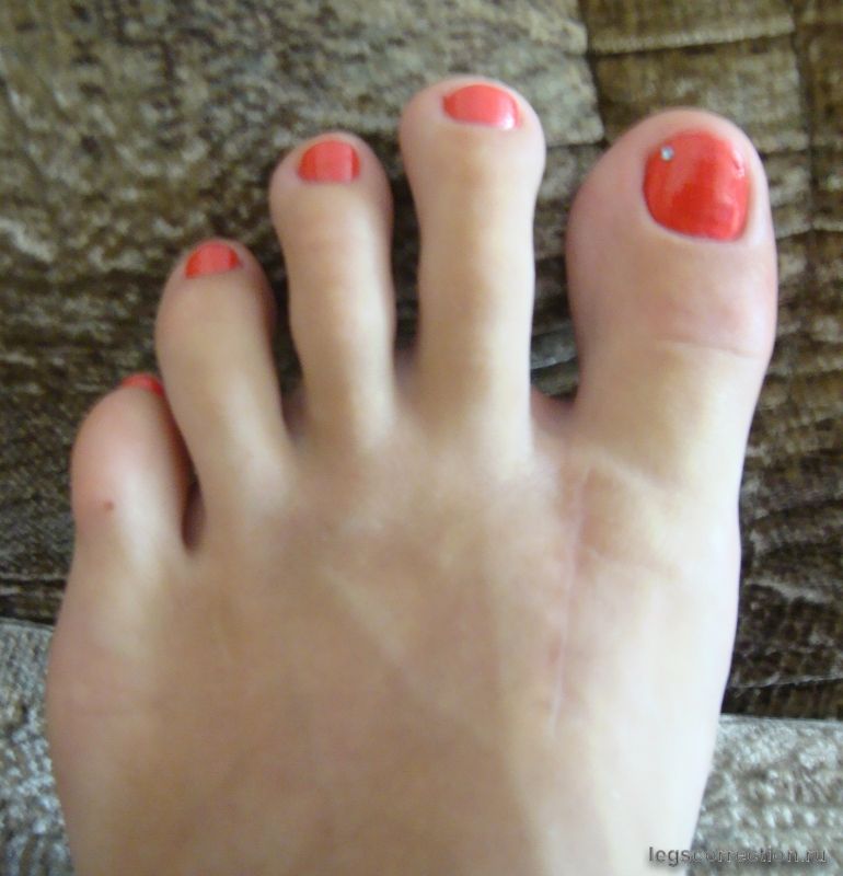 Dsc03966