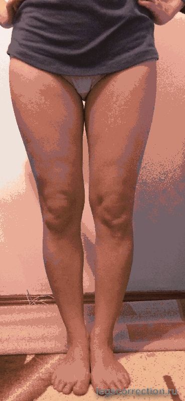 До