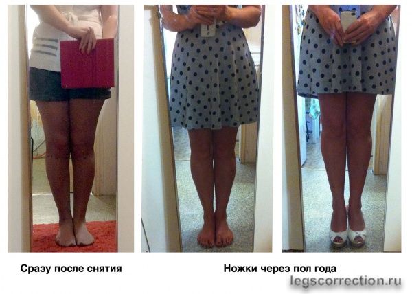 результат через пол года
