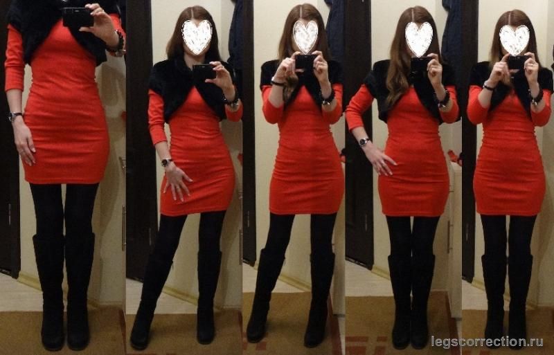 В новый год на новых ножках!