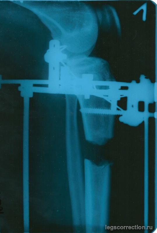 0002