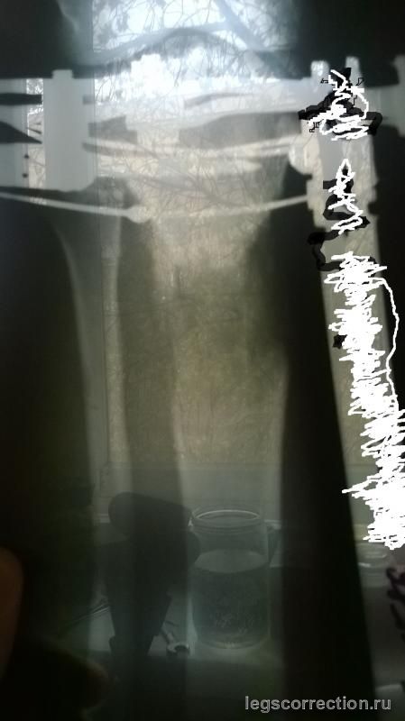 2015-04-17 11-17-33