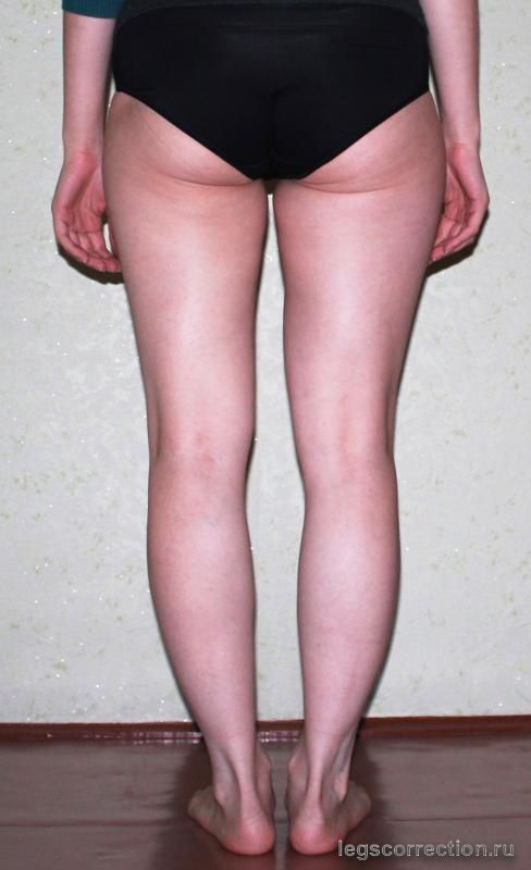 Photo 01