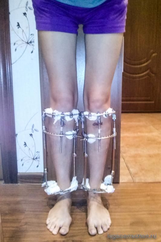 Cam00873