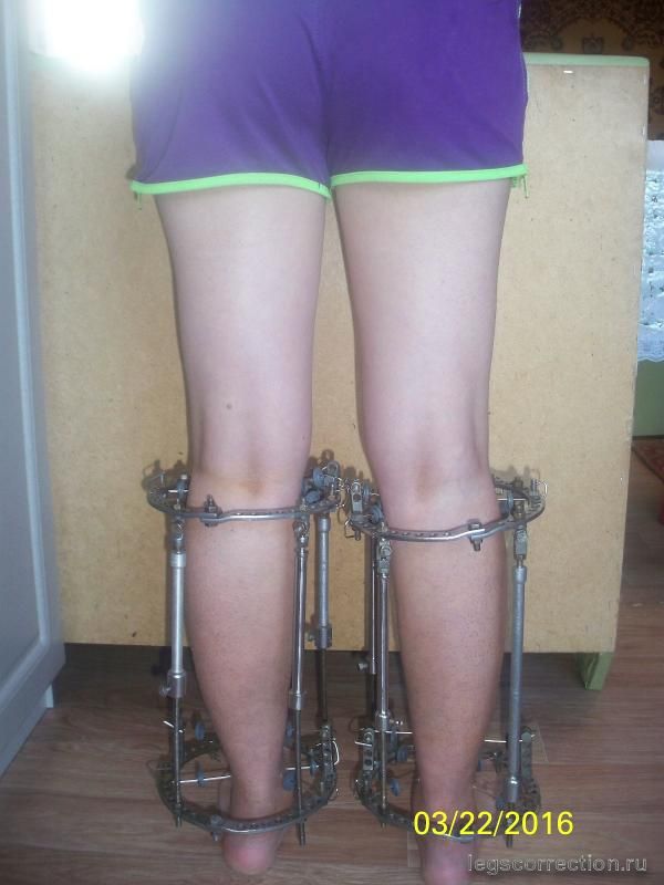 100 0507.jpg-3