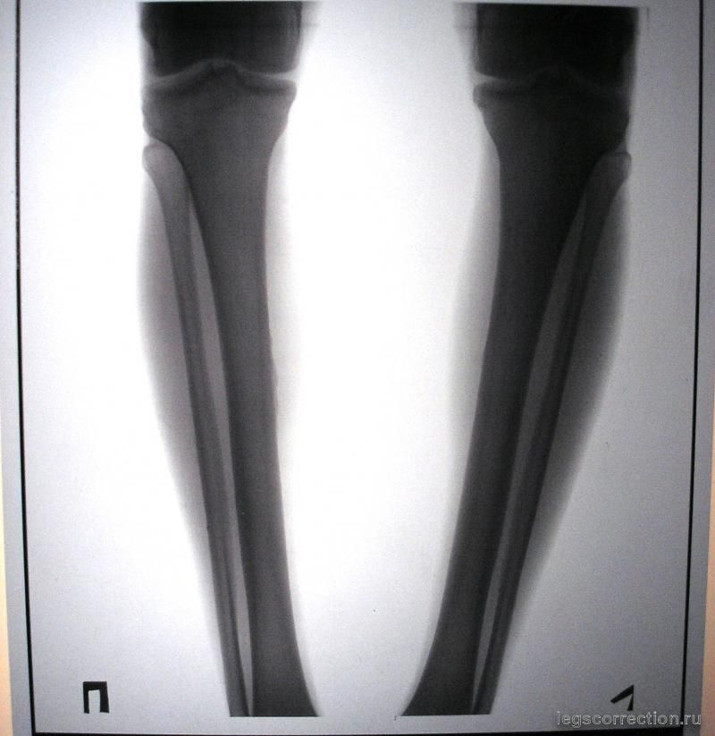 P1010025