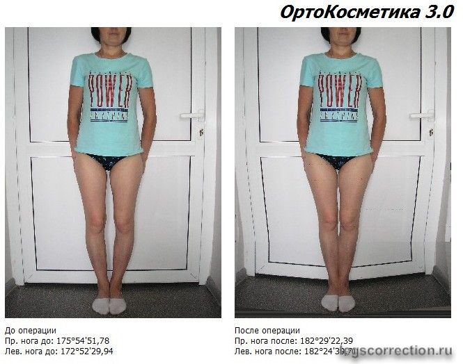 моделирование на -2 градуса