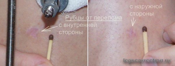 Метаморфозы моих ножек