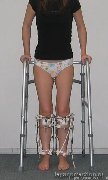 Img 0004
