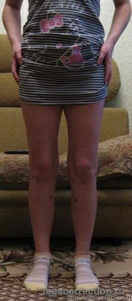 Img 0642
