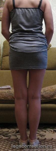 Img 0651