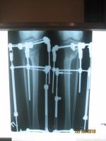рентген - 4 мес 28 дней прямая проекция