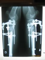 рентген - 4 мес 28 дней - боковая проекция