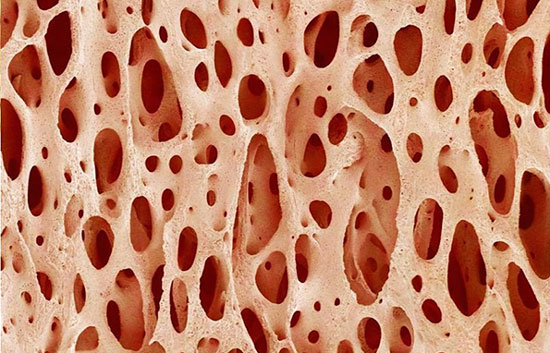 Виды костной ткани
